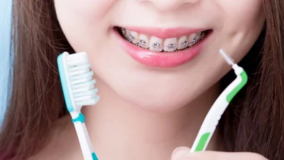 How Often Should I Brush My Teeth with Braces