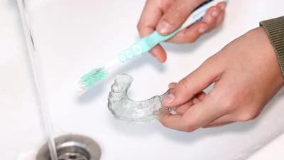 How to Clean Plastic Dental Retainers at Home Safely