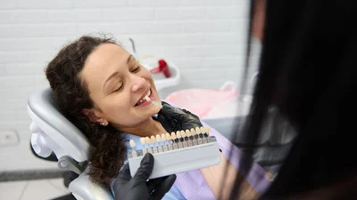 How Long Does the Veneers Process Take