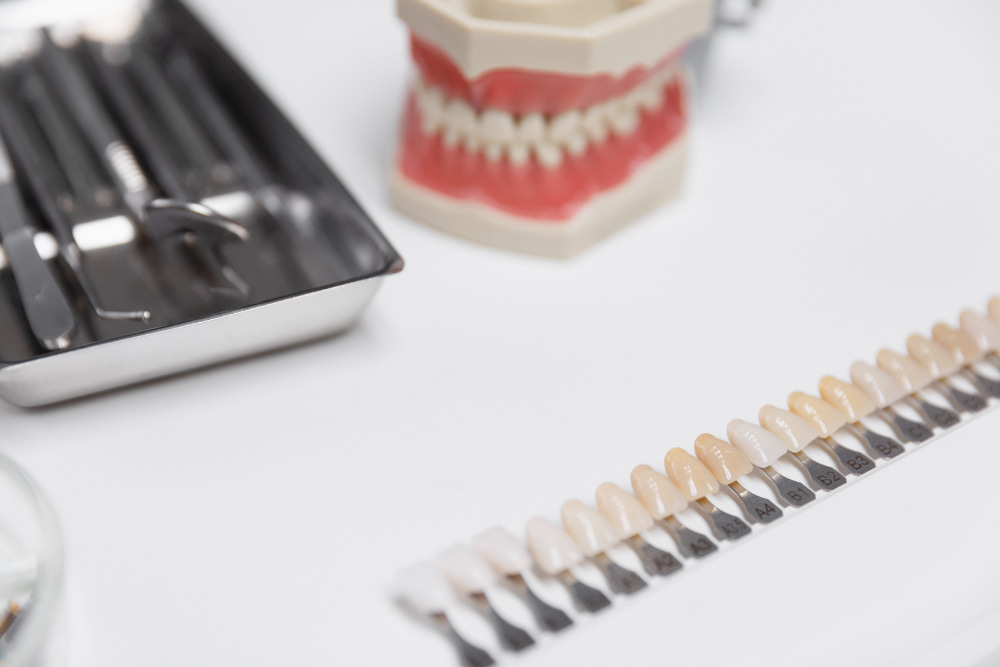 Dental tools on a metal tray, a model of teeth in the background, and a gradient of tooth shade samples on a white surface.