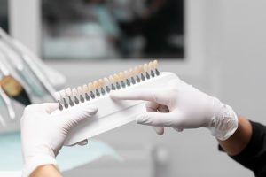 Close-up of a dentist's gloved hands holding a dental shade guide to match tooth color for crowns or veneers.