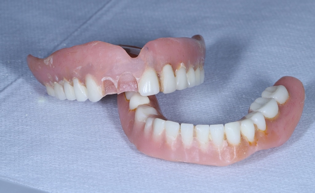 Repair a Broken Denture