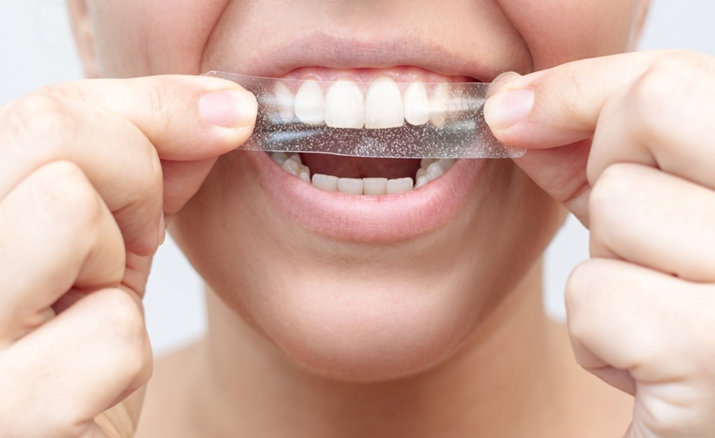 Brush My Teeth After Using Whitening Strips​