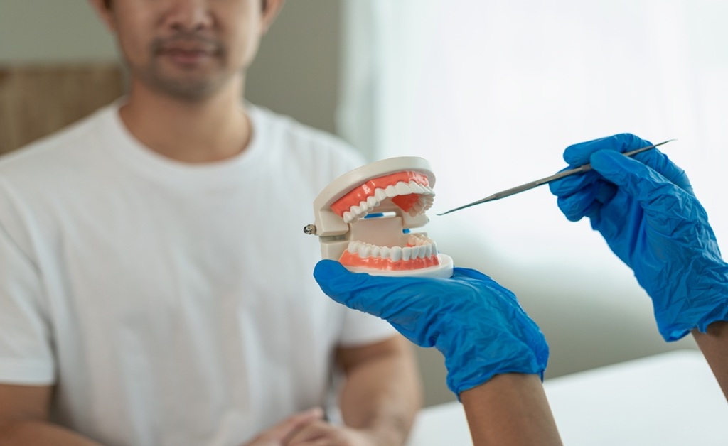 Dental Implants