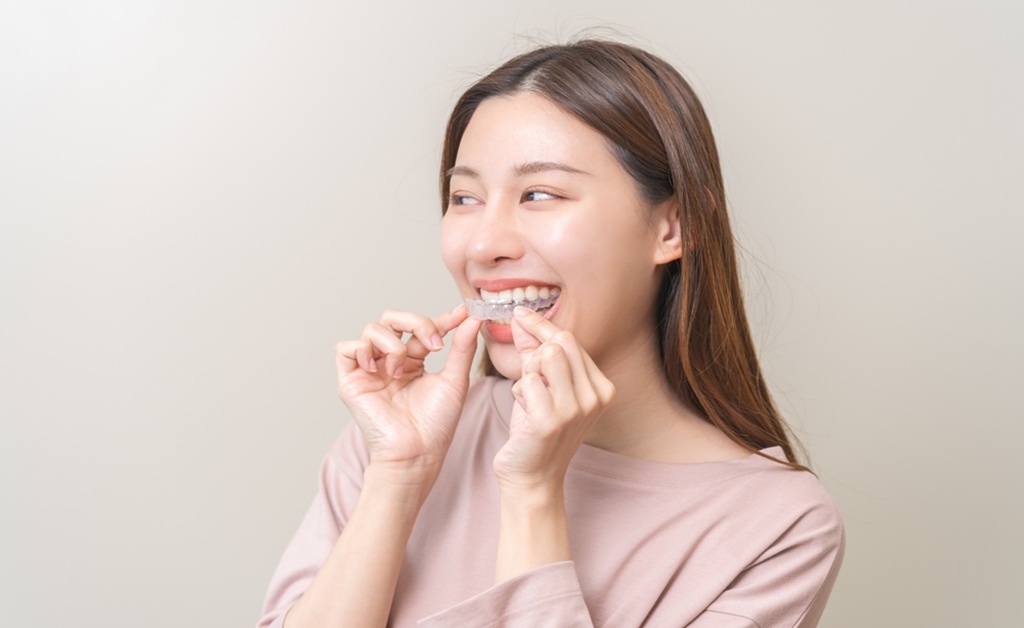 for Invisalign to Work