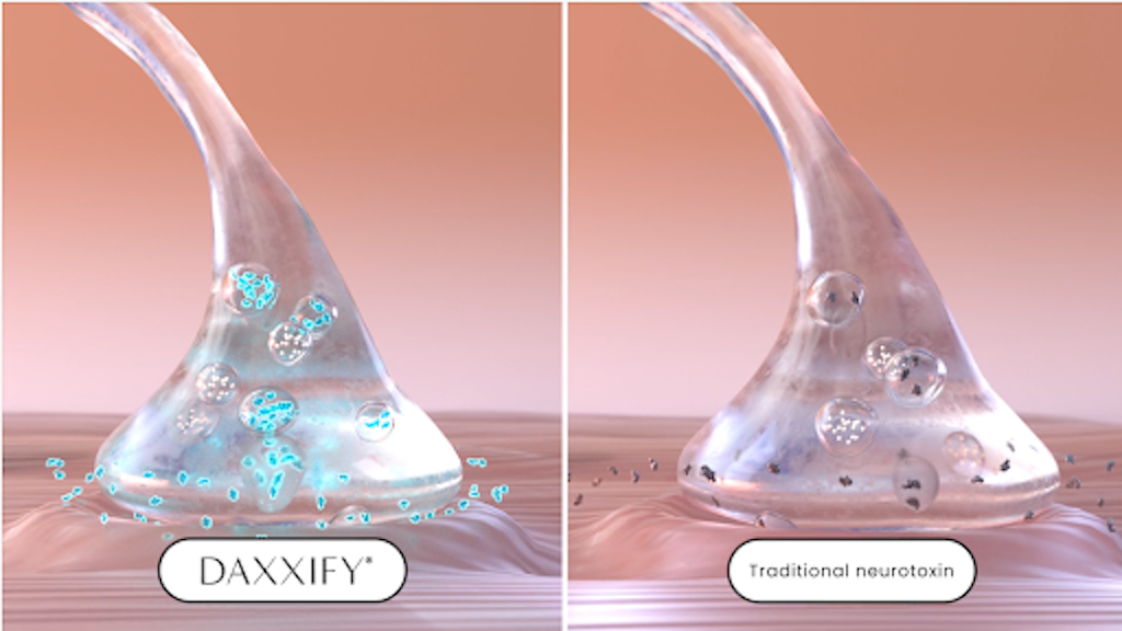 Neuromodulator Treatment in OKC